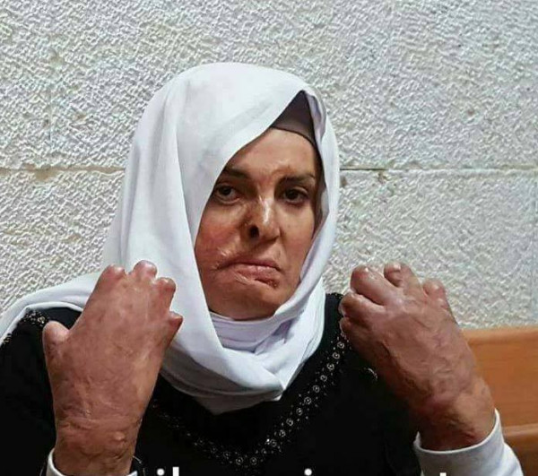 حماية يدعو للتحرك الفوري لإنقاذ حياة الأسيرة الجعابيص، ويطالب بالعمل الجاد لاطلاق سراحها من السجون الاسرائيلية